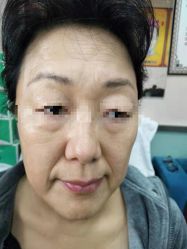 -北京美痣堂古方祛痣斑疣瘊
