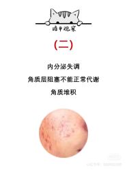 -凡碧诗毛孔清洁收细