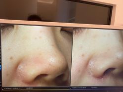 点击看大图 -苑苑vbeauty科技美容SPA