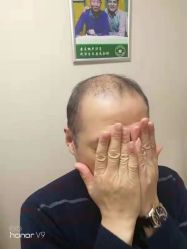 -唐风采假发补发定制