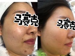 -康美贞·痘肌养护管理中心