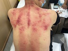 -郑远元专业修脚房(番禺路店)