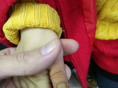-Andrew指甲专科灰指甲·甲沟炎矫正·3D步态矫形鞋垫定制(上海法华镇路旗舰店)