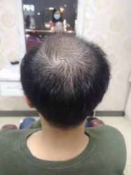 -唐风采假发补发定制