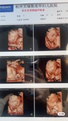 -杭州贝瑞斯美华妇儿医院·早孕·产检·儿科