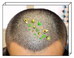 -大麦微针植发全国连锁