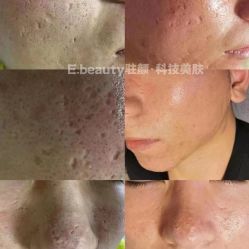 -E.beauty驻颜·痘敏肌调理中心