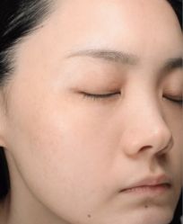 -SKINIST丽铂医疗美容