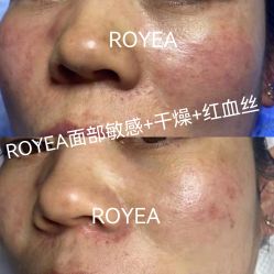 -ROYEA茹彦祛痘·问题肌肤修护中心