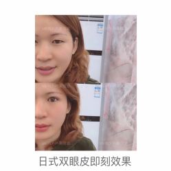 -MLP美丽派·问题肌疗愈中心