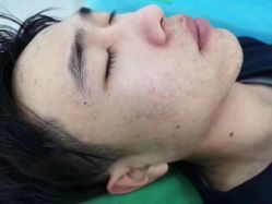 -苗方清颜痘肌研究所