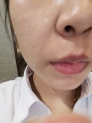 体验前-上海宏康医院·医疗美容科