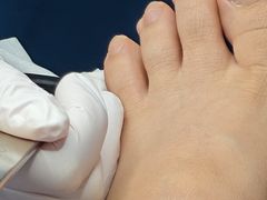 -Andrew指甲专科灰指甲·甲沟炎矫正·3D步态矫形鞋垫定制(上海法华镇路旗舰店)