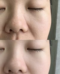 -SKIN79皮肤管理中心