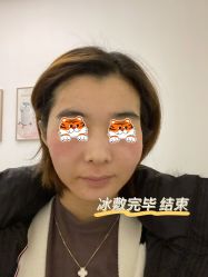 -agge蛋白医美