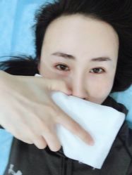 点击看大图 体验后-北京炫美医疗美容