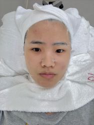 -苗方清颜专业祛痘·皮肤管理