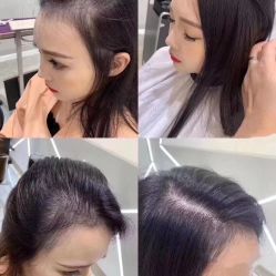 -LESSMORE科技头皮理容中心