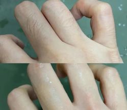 -HEYAN荷妍专业脱毛连锁机构