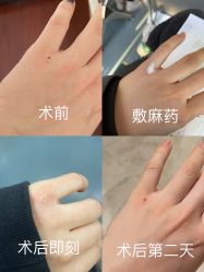 体验前-空军总医院激光整形美容中心