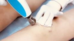 -成都军建医院·疤痕诊疗中心