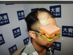 -大麦微针植发丨全国连锁