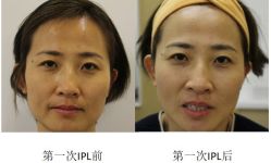 -丰联丽格医疗美容·联合丽格眼整形中心