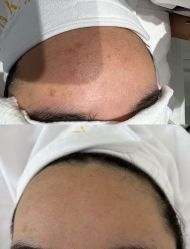 -康美贞·痘肌养护管理中心