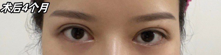 -素美医疗美容·西南眼鼻整形·修复基地