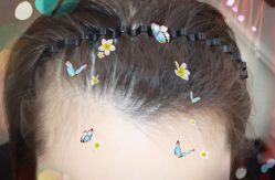 -大麦微针植发全国连锁