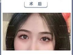 -四川省人民医院(本部)