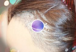 -大麦微针植发全国连锁