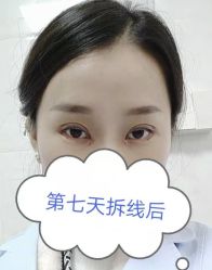 -素美医疗美容·西南眼鼻整形·修复基地