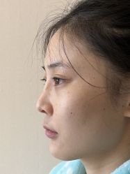 -北京米扬丽格医疗美容·联合丽格鼻整形中心