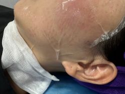 -广州美莱医疗美容医院