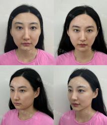 -Yestar艺星医疗美容医院