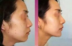 点击看大图 -SKINIST丽铂医疗美容