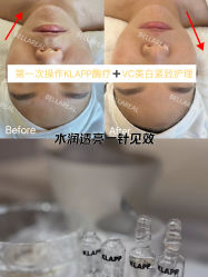 -BELLAREAL新美社