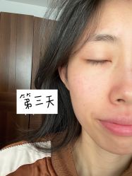 -海峡医疗美容医院