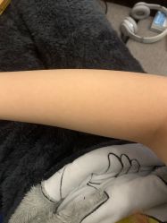 体验后-原力医疗美容