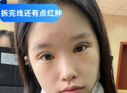 -素美医疗美容·西南眼鼻整形·修复基地