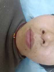 -长沙雅美医疗美容医院