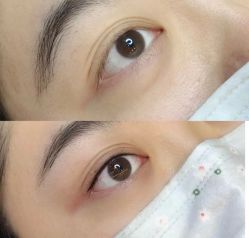 -美肤盾祛痘·问题肌头疗管理中心