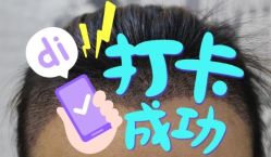 -大麦微针植发全国连锁