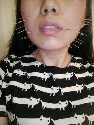-肥三针腧穴瘦身馆