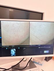 -苑苑vbeauty科技美容SPA