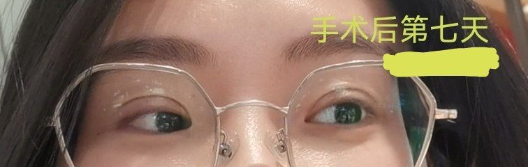 -美莱医学美容医院