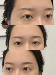 -张小野·专业半永久纹眉