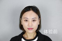 体验前-昆明梦想医疗美容医院