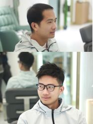 -发饰美男士增发补发假发定制店